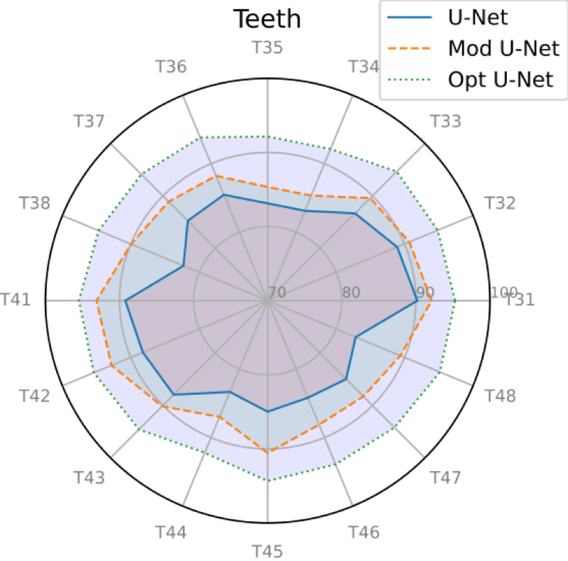 image: 1_Users_florent_MyPapers_Soumissions_Conference___ials_images_RadarPlots_RadarPlot_Upper_Dice.png