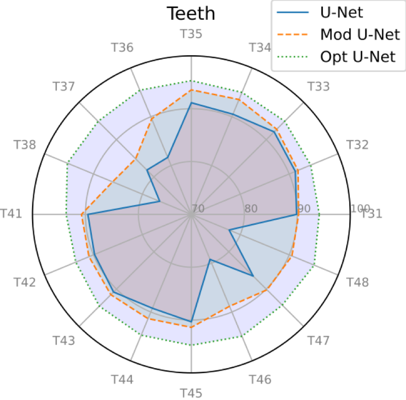 image: 2_Users_florent_MyPapers_Soumissions_Conference___ials_images_RadarPlots_RadarPlot_Lower_Dice.png