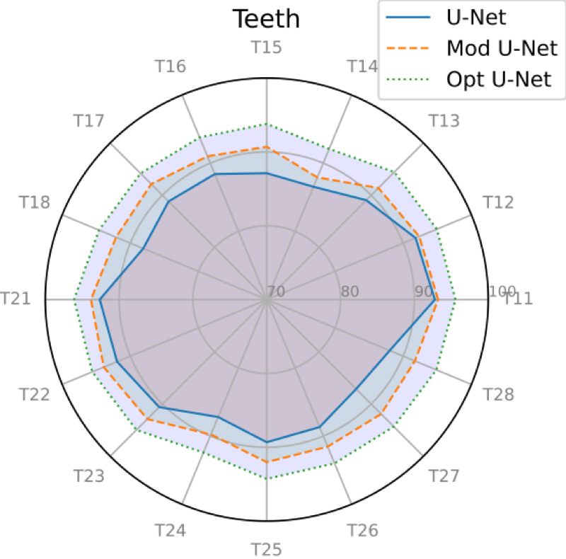 image: 3_Users_florent_MyPapers_Soumissions_Conference___y_Materials_images_RadarPlots_NM_Upper_Dice.png