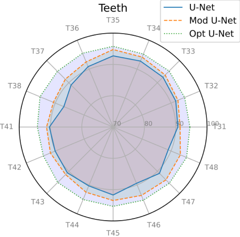 image: 4_Users_florent_MyPapers_Soumissions_Conference___y_Materials_images_RadarPlots_NM_lower_Dice.png